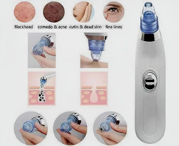 Derma Suction Blackheads Remover 3 In 1 Black Head Remover CVO Mart